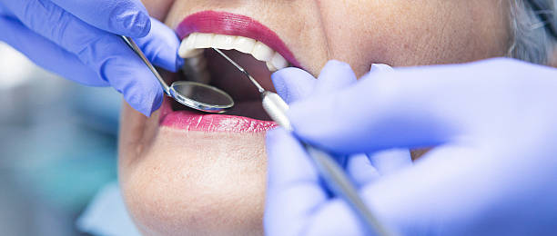 Best Emergency Dental Care for Broken or Chipped Teeth in Mount Dora, FL